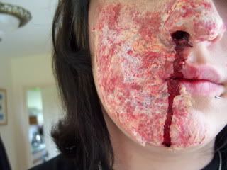 facial burn acid Nude centerfold scans